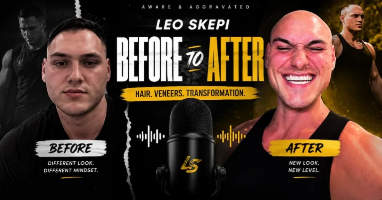 Leo Skepi before and after transformation showing hair, veneers and style change